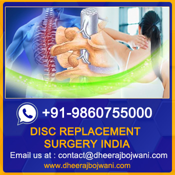 Disc Replacement Surgery, Bangalore